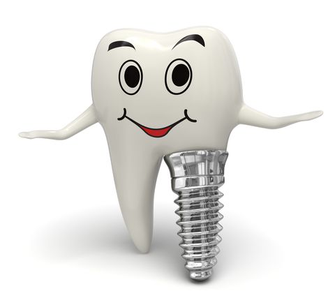 Cách chăm sóc răng implant như thế nào?