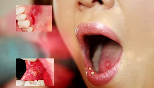 Những vấn đề răng miệng không nên bỏ qua