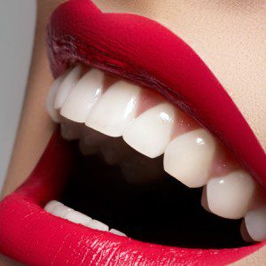 Tẩy trắng răng duy trì được bao lâu?